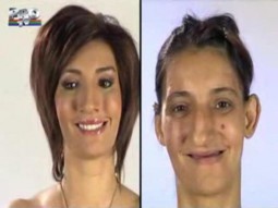 20 de chestii care-ti strica dintii